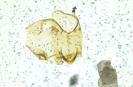 Reste von Zuckmückenlarven unter dem Mikroskop, Foto: A. Bolland