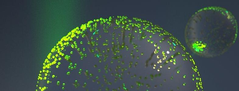 zur Vergrößerungsansicht des Bildes: Computergenerierte Grafik eines Polymerpartikels mit vielen Goldnanopartikeln auf der Oberfläche, die mit grünem Laserlicht bestrahlt werden