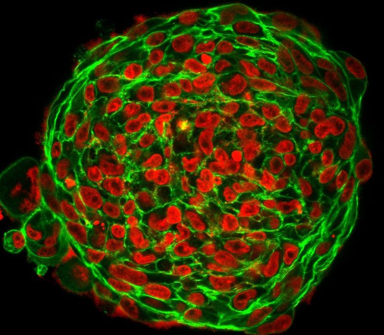 Aktin- und DNA-Färbung verraten die Struktur von 3D-Tumorclustern. Zellformen in Krebstumoren zeigen an, ob die Zellen beweglich sind.